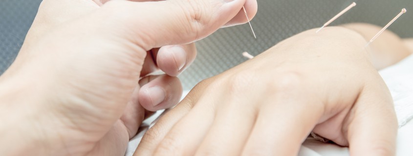 Community Supported Acupuncture
